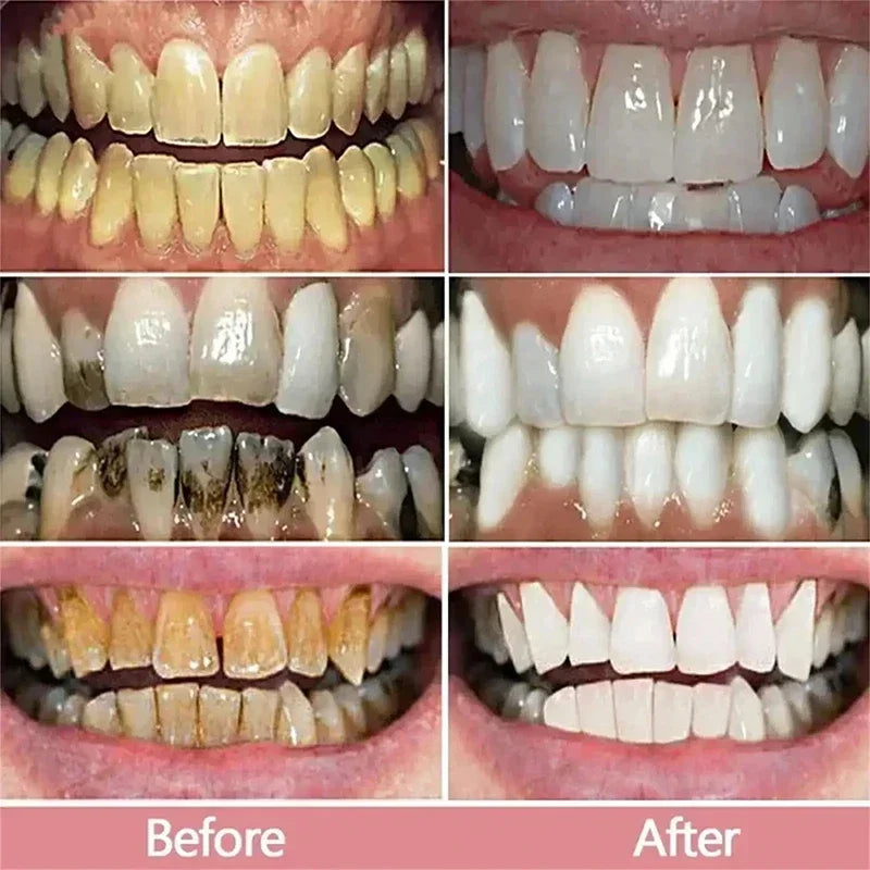 Pasta Dental Blanqueadora 5D Limpieza Profunda y Aliento Fresco
