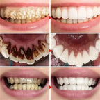 Pasta Dental Blanqueadora 5D Limpieza Profunda y Aliento Fresco