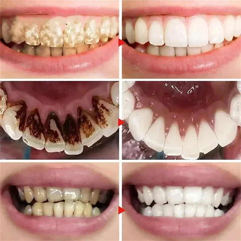 Pasta Dental Blanqueadora 5D Limpieza Profunda y Aliento Fresco