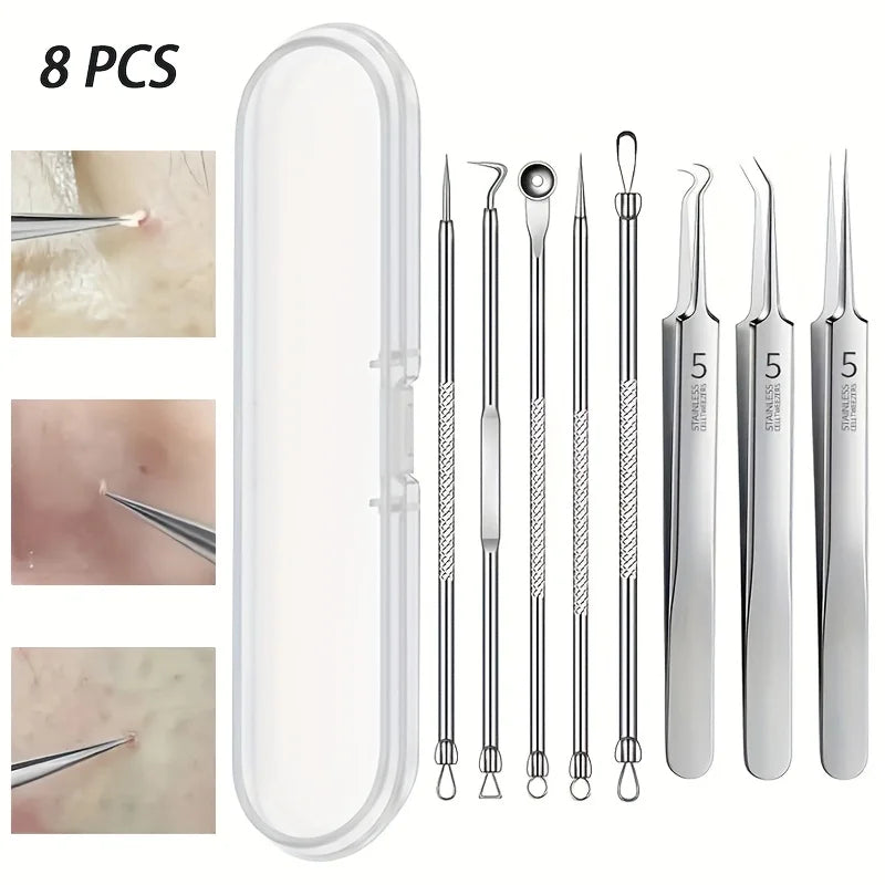 Kit Removedor de Puntos Negros 8 Piezas Acero Inoxidable Profesional